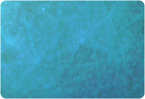 Sebum, Before and After Treatment on skin
