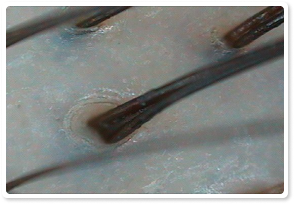 After Treatment 3