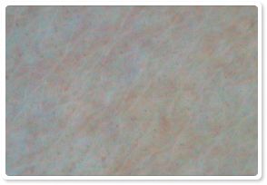 After Treatment 6