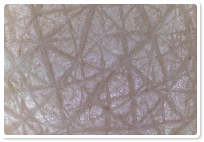 After Treatment 7