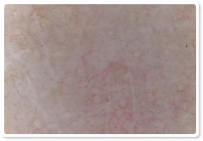 After Treatment 8