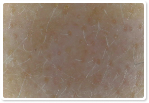 After Treatment 9