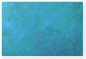 After Treatment 10