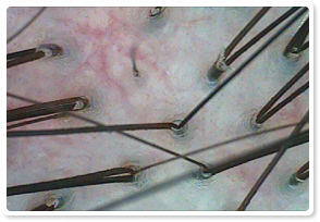 Before Treatment 1
