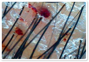 Before Treatment 2