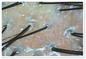 Before Treatment 3