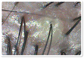 Before Treatment 4