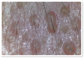 Before Treatment 7