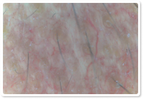 Before Treatment 8