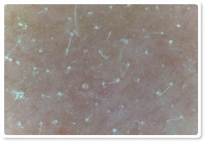 Before Treatment 9
