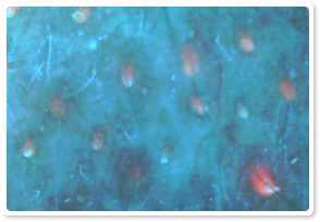 Before Treatment 10