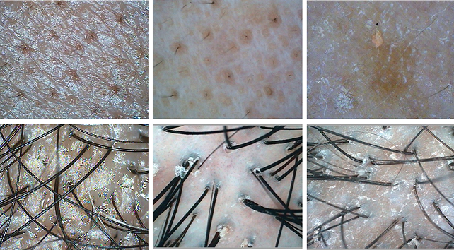 Tested Pictures