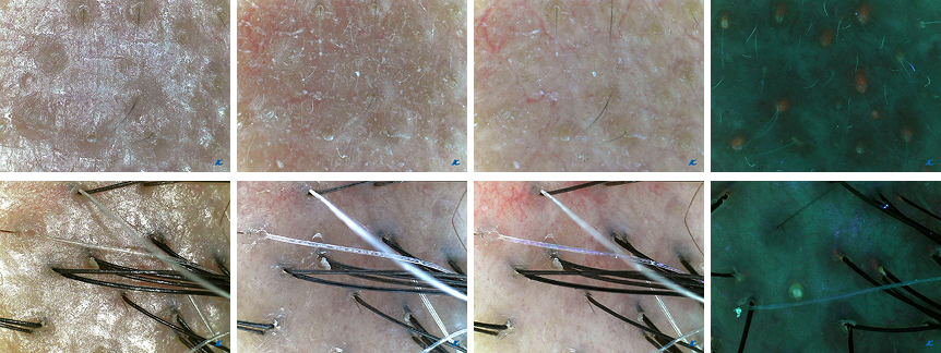 Tested Pictures