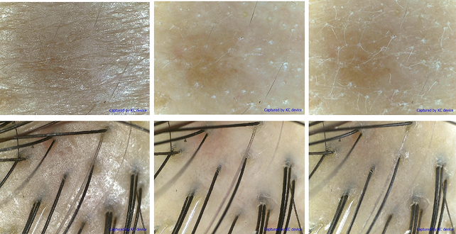 Tested Pictures